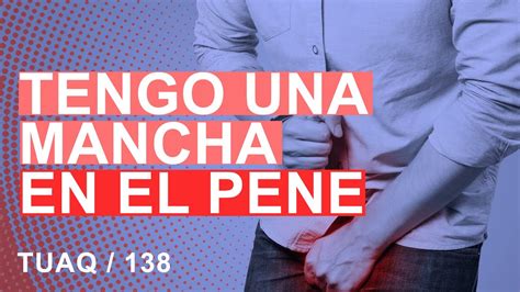 manchas en el pen negras|Causas de las manchas en el pene